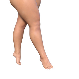 超重女性双腿