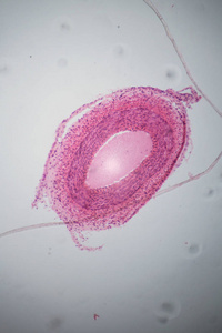 在显微镜下静脉段照片