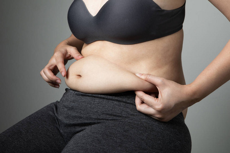 肥胖妇女脂肪团腹部不健康