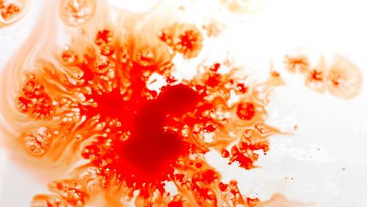 水槽里的血靠近照片