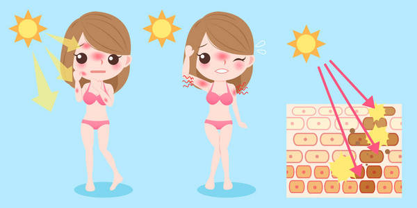 晒伤问题的女人猫和老鼠在海滩上胡闹天热人手机沙滩帽上面木制卡通桌