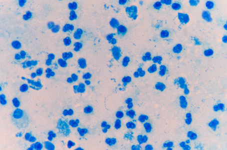 中度蓝色白血细胞