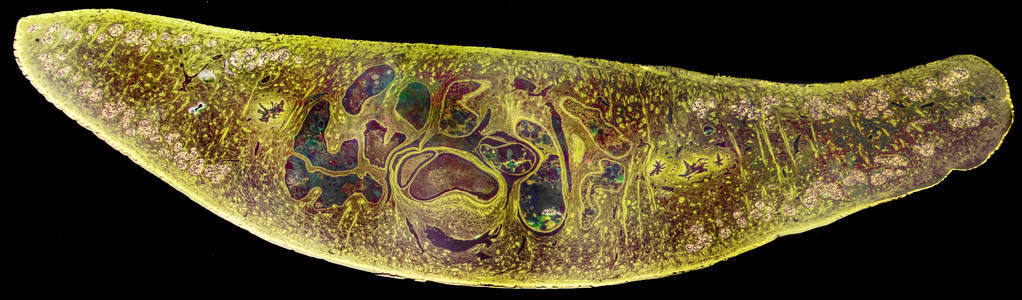 肝片吸虫结构图图片