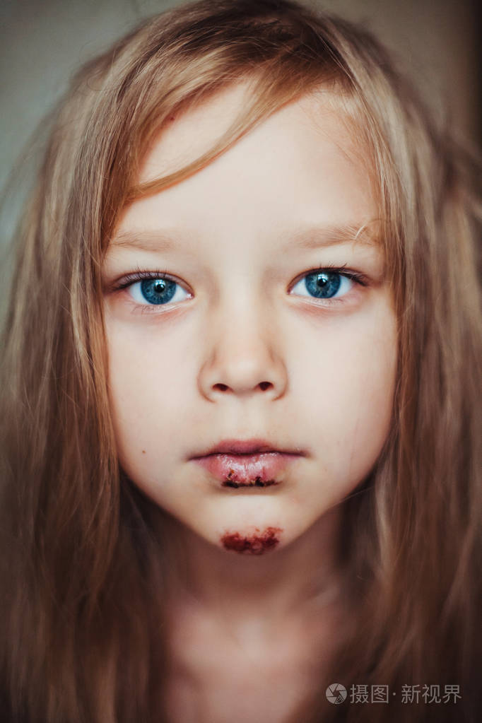可爱的小女孩,绕在她的脸上的血