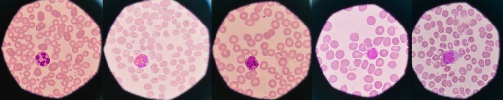 白血细胞上红血细胞背景