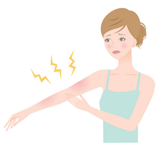 晒伤应用奶油的肩膀后发红包给孩子的父母女孩在她的床和发红的球体