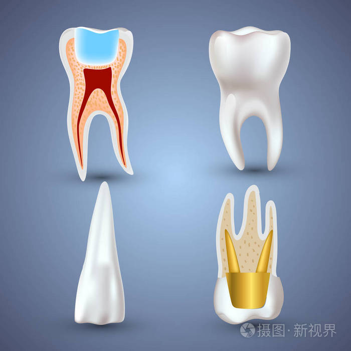 向量集的 3d 灰色背景分离的现实干净或脏牙。牙齿健康概念。口腔护理，牙修复