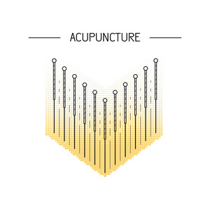 acupunkture 中国传统医学