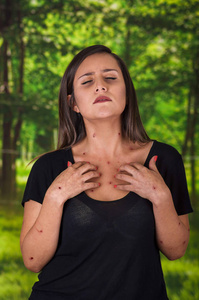 年轻的女人穿着一件黑色的衬衫和患有痒后被蚊子叮咬，在模糊的绿色背景