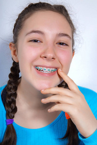 微笑着十几岁的女孩戴着牙套的牙齿