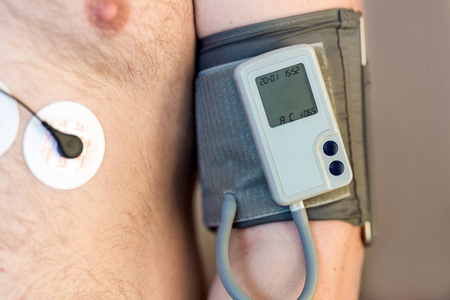 人类男性身体动态监测仪和每日血压记录仪。每日心电图监测。超重的人。患心脏病的高危因素。卫生保健与疾病预防