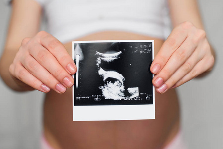 怀孕女孩手上的孕妇超声照片