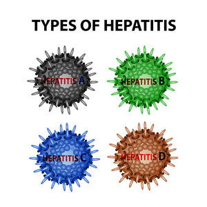 肝炎的类型。病毒 A, 乙, C, d 图表。独立背景上的矢量插图