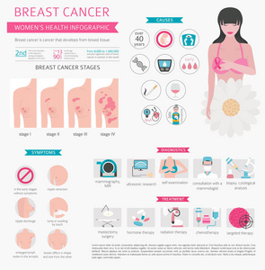 乳癌, 医疗图表。诊断, 症状, 治疗。妇女健康的集合。矢量插图