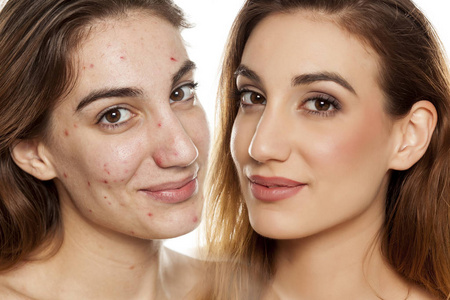 美容治疗前后同一妇女的比较肖像白色背景化妆照片