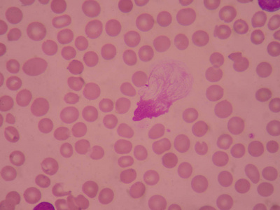 篮子细胞的红细胞背景。医学科学概念