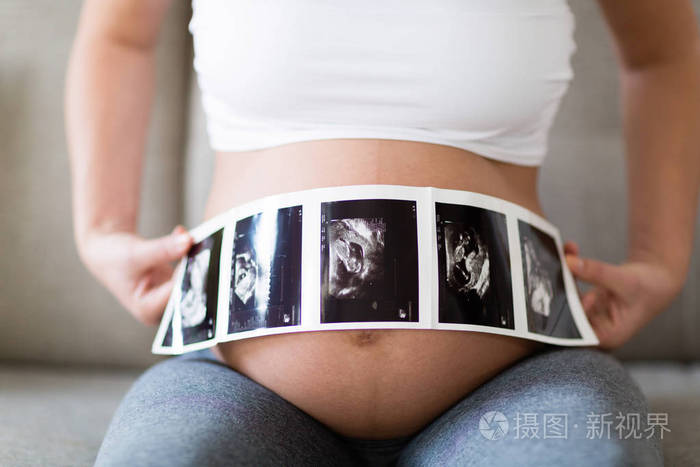 孕妇手持超声波照片在她的腹部