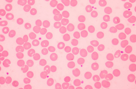 Normochromic nomocytic 红细胞。医学科学概念