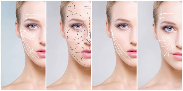 女性面部整形图片