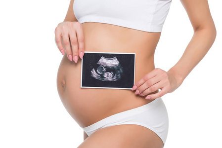 孕妇与超声扫描