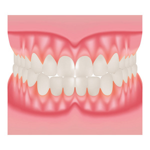 与洁白的牙齿，牙牙龈的上部和下部的下巴，在白色背景上孤立闭塞咬的假牙。矢量图