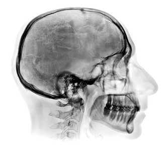 详细的人类头骨 x 射线图像