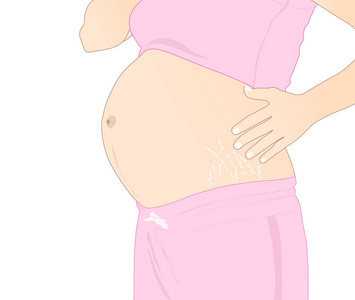 腹部长妊娠纹图片