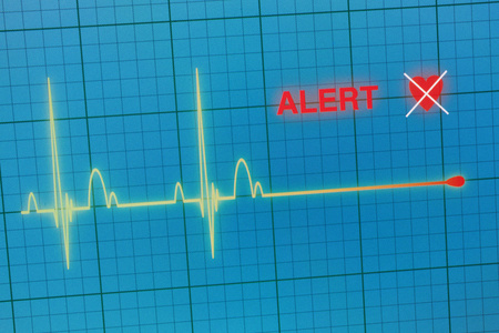 显示器上的心跳心动图照片