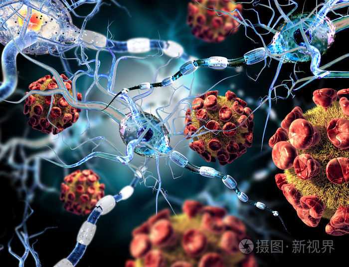 抑郁症前兆十大症状表现_腹部肿瘤的症状10大前兆_心梗症状前兆9大表现