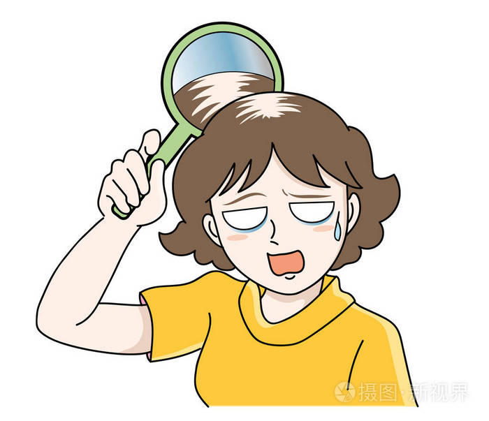 女性脱发的麻烦