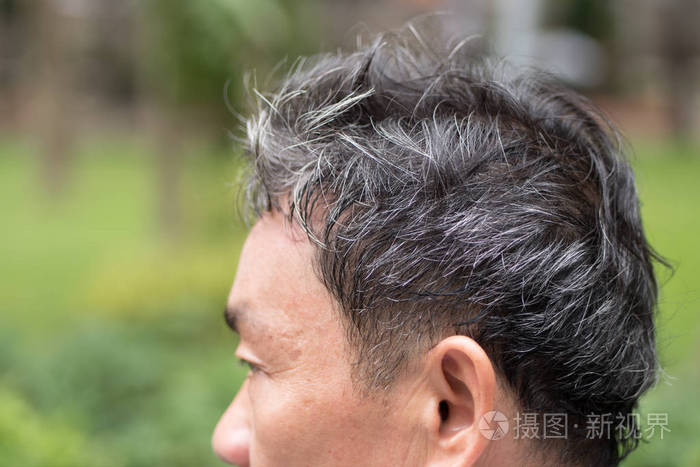 老高中级岁满头白发的问题