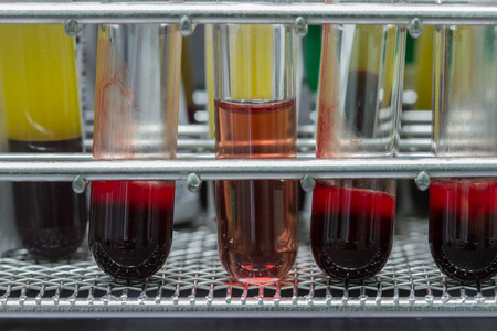 医疗设备的血液测试实验室