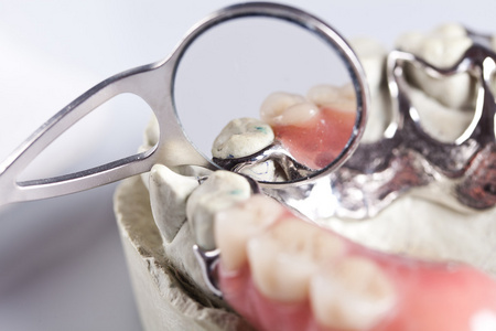 牙科检查和牙齿护理服务