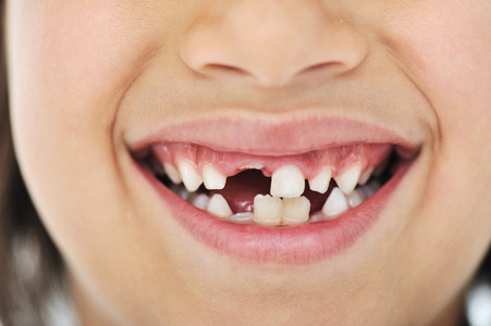 差距齿的鬼脸丢失的乳齿,长头发的可爱男孩照片