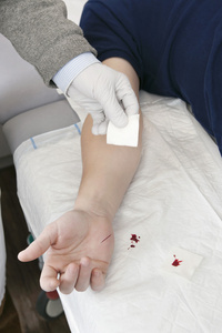 清洗伤口清洗切照片