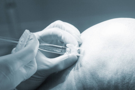 在手术中的麻醉注射照片