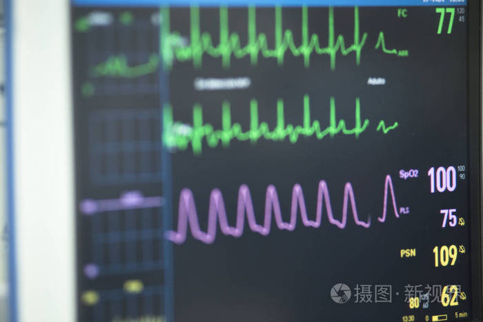 心电图在医院手术