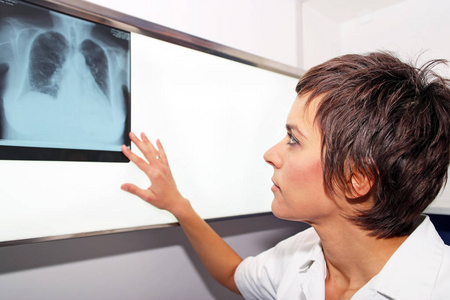 X 射线的肺，肺栓塞 pe，肺动脉高压，C