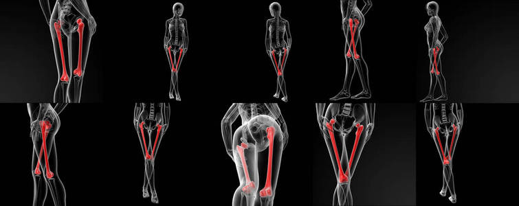 股骨三维渲染图