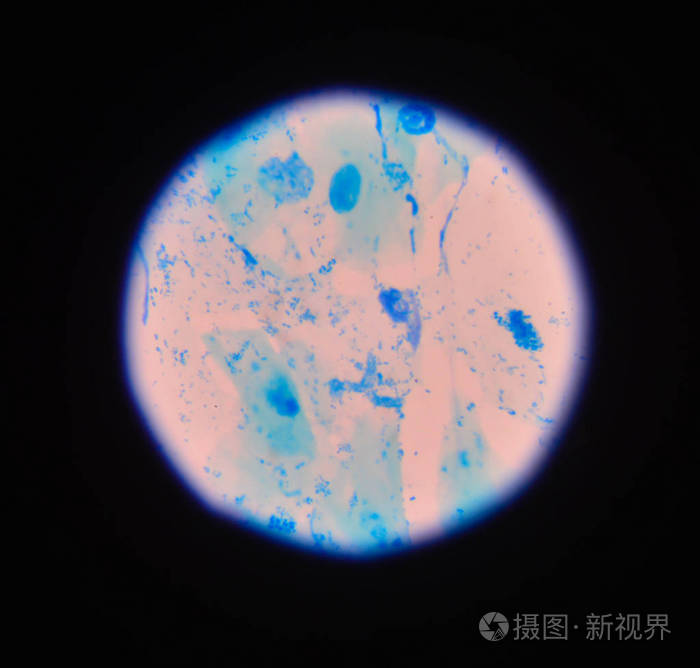 革兰氏染色 也被称为克的方法 是一种不同的方法照片 正版商用图片0wbnf3 摄图新视界
