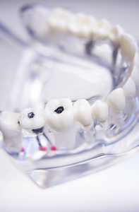 牙医牙科牙齿模型图片