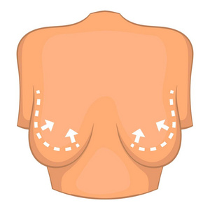 女性乳房发育过程图片