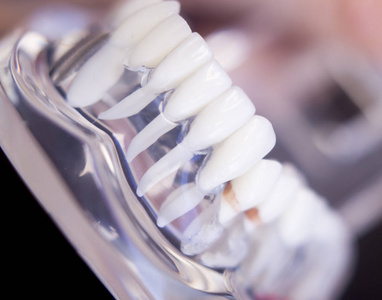 牙医牙科牙齿模型图片