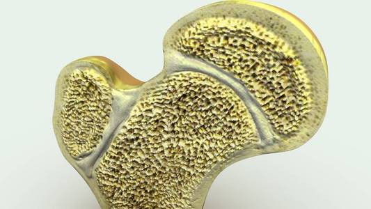 软骨关节关闭照片