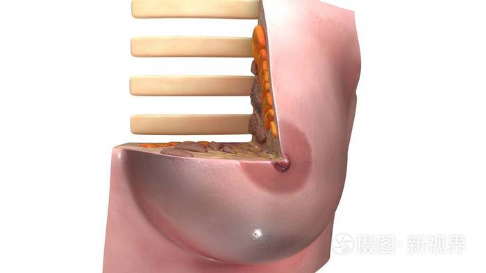 交叉口的乳房图照片-正版商用图片0wi773-摄图新视界