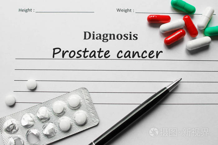 前列腺癌在诊断名单上，医学概念