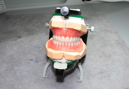 全口义齿咬合在蜡模型照片