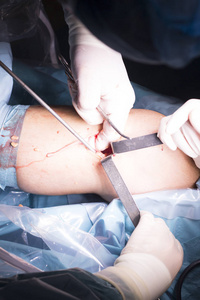 外科手术膝盖手术