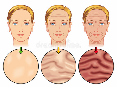 皮肤老化图片