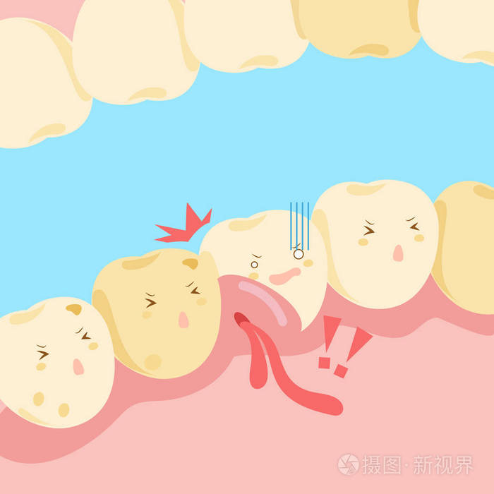 卡通牙齿与牙龈肿胀插画-正版商用图片0wsuen-摄图新视界